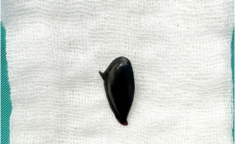 hóc hạt hồng xiêm.jpg