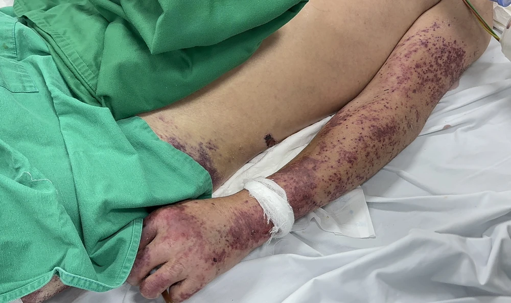 chế biến thủ lợn.jpg