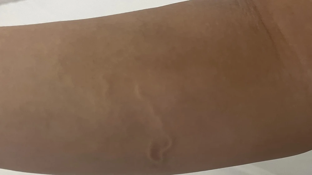 giun ký sinh trùng ở người.jpg