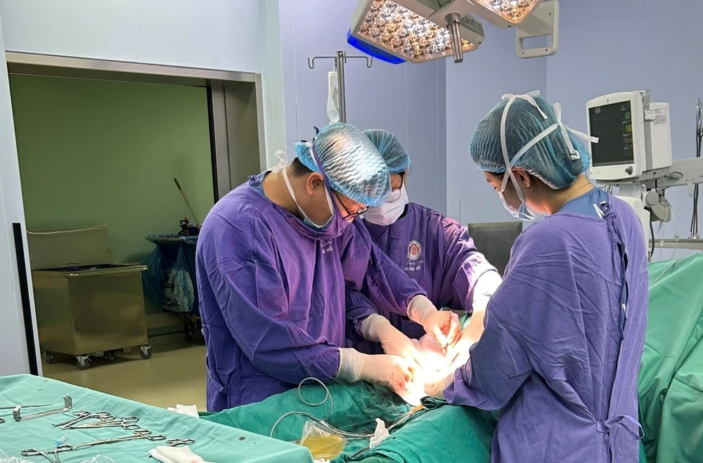 áp xe túi tinh.jpg