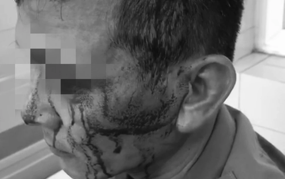 Bảo vệ Bệnh viện K.jpg