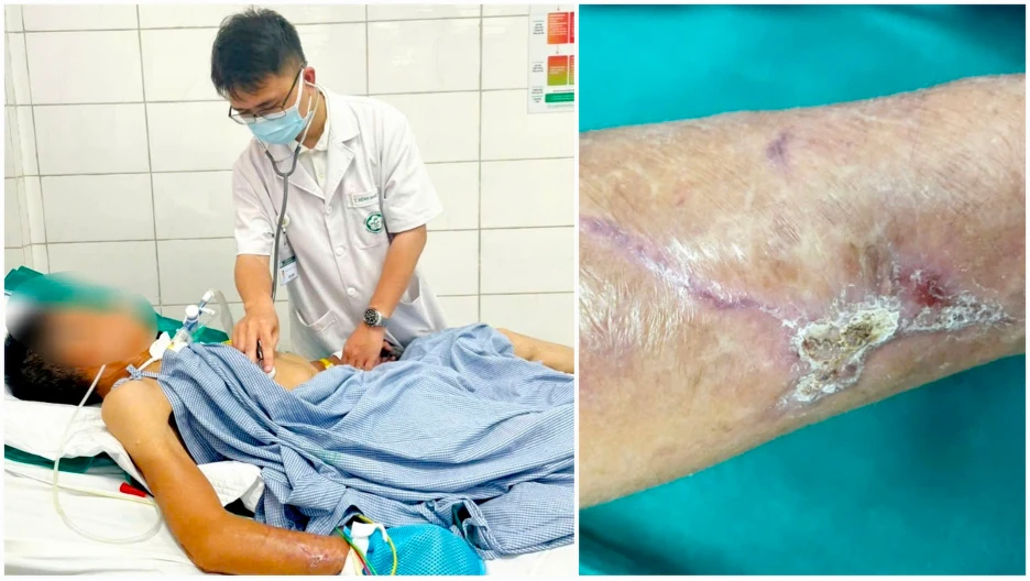 bệnh uốn ván 1.png