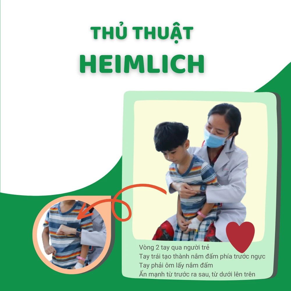 Thủ thuật xử lý khi trẻ bị hóc