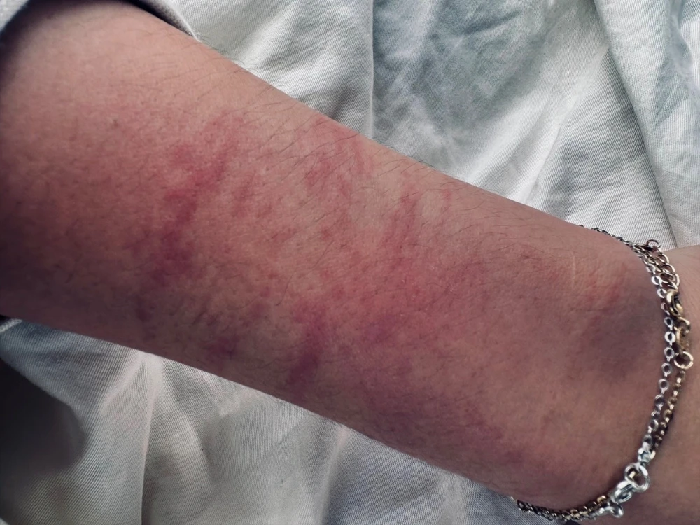 nữ bệnh nhân.jpg