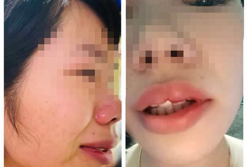 Cô Vũ Thị Kim Quy bị đánh gây thương tích. Ảnh: NVCC