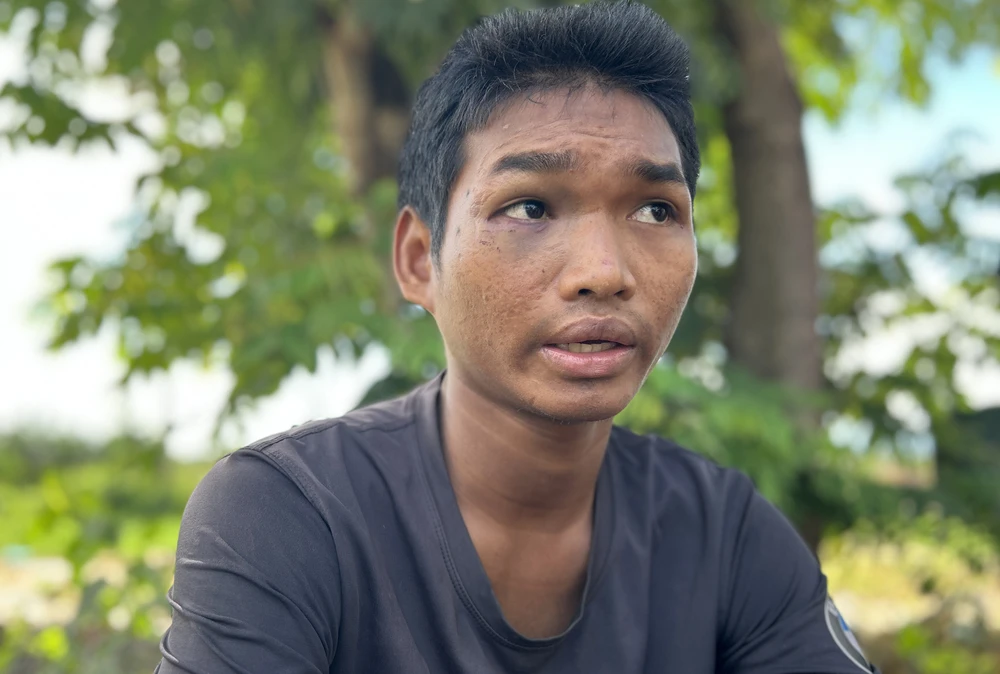 Anh Y Dũn BKrông vẫn còn bị ám ảnh khi nhớ lại cảnh mình bị bắt cóc. Ảnh: VŨ LONG