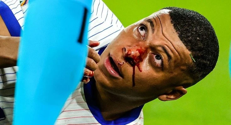 Euro 2024 quá nguy hiểm