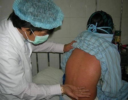 Xuất hiện ổ dịch rubella tại Bình DBình Dương: Phát hiện ổ dịch rubella trong khu lưu trú công nhân ảnh 1