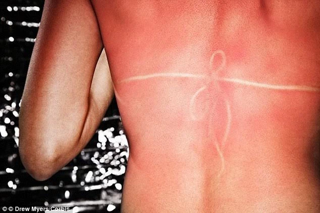 8 vấn đề sức khỏe trong mùa hè và cách khắc phục ảnh 3 8 vấn đề sức khỏe trong mùa hè và cách khắc phục ảnh 3