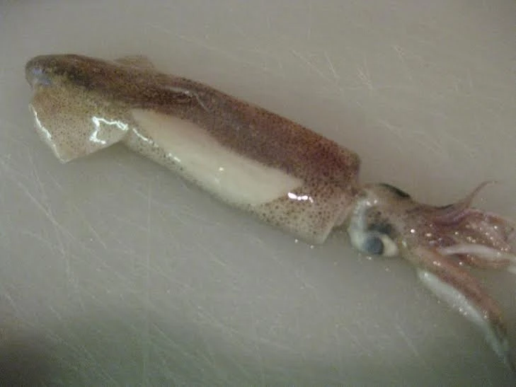 Rùng mình: 20 dạng vật lạ trong cơ thể người ảnh 17