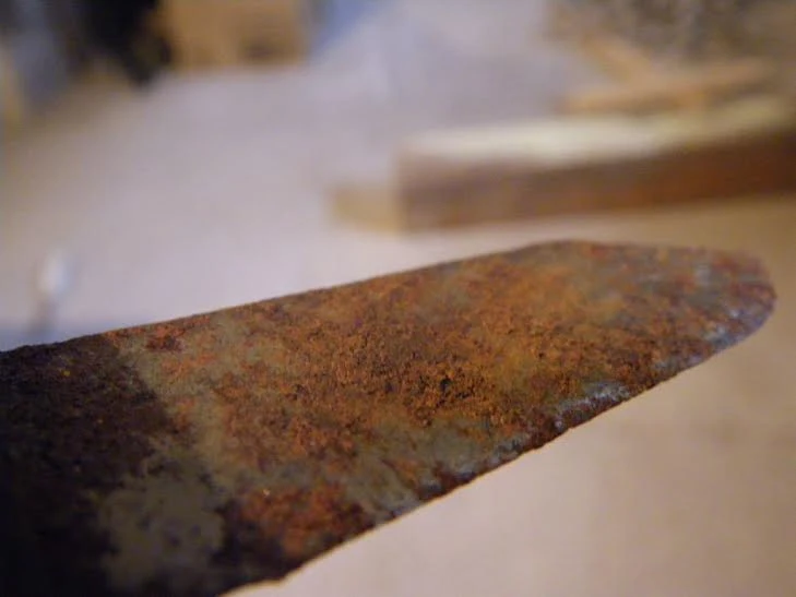 Rùng mình: 20 dạng vật lạ trong cơ thể người ảnh 3