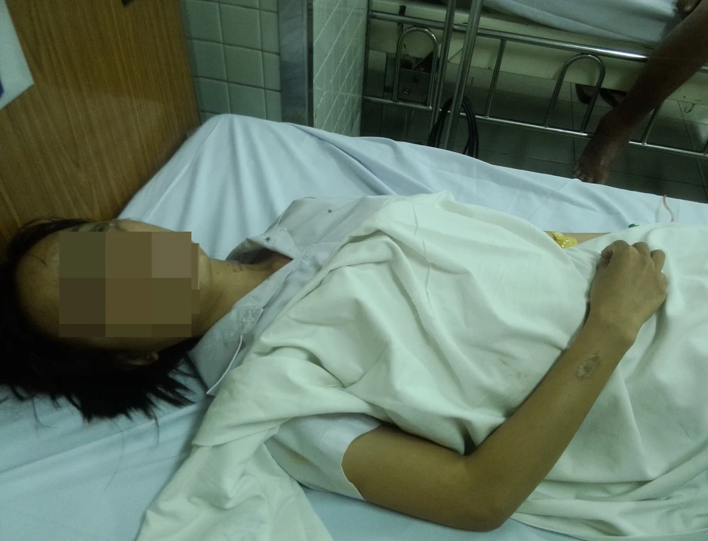 2 nữ sinh bị tạt acid, một người bỏng nặng ảnh 1