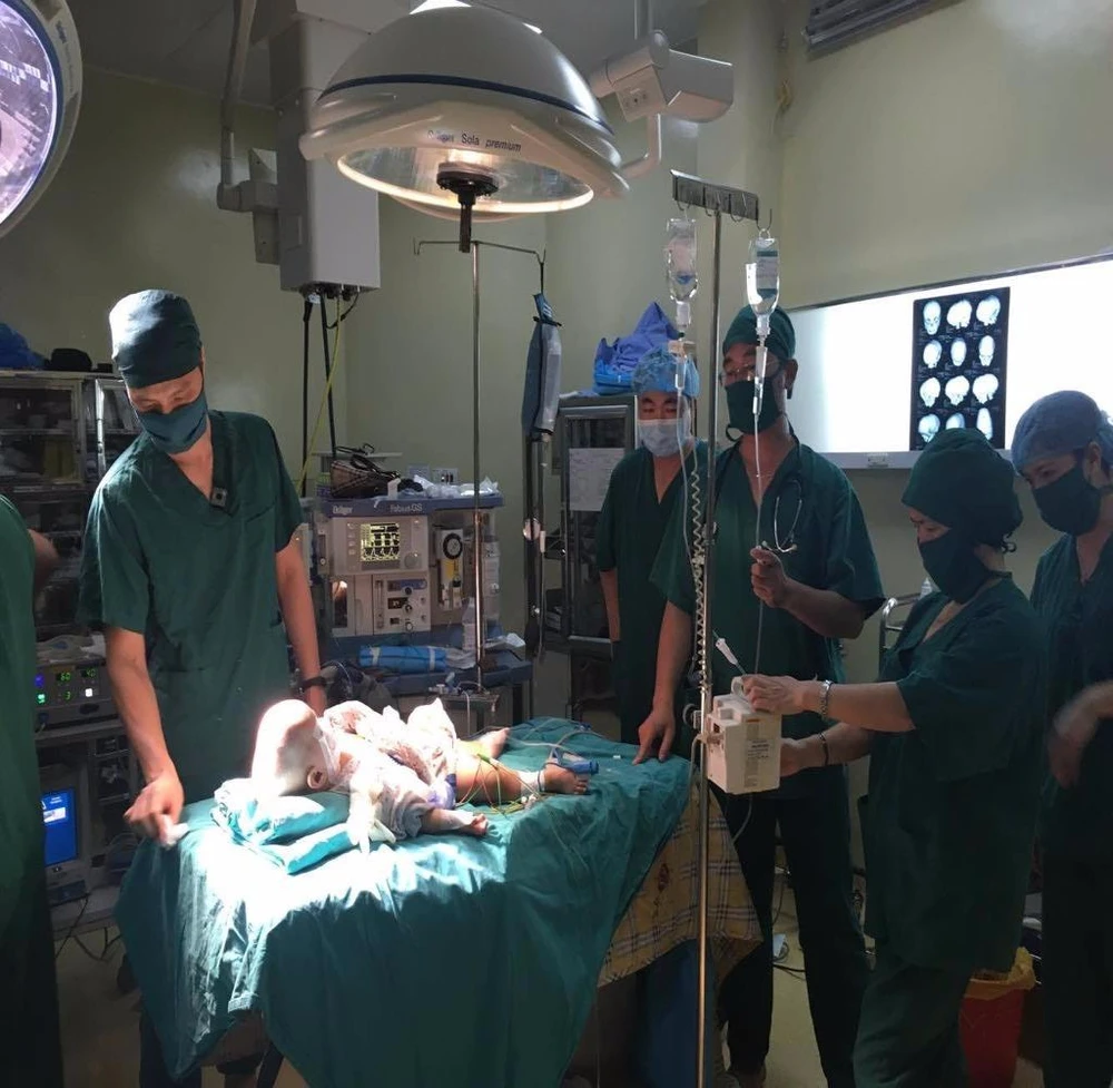 phẫu thuật dị dạng hộp sọ cho bé L