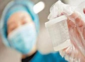 Nam giới có thể dị ứng với tinh dịch của chính mình