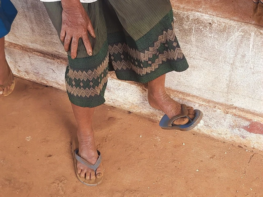 Không ít bà con Lào mang dép khác màu đến điểm khám bệnh, phát thuốc miễn phí. Ảnh: TRẦN NGỌC