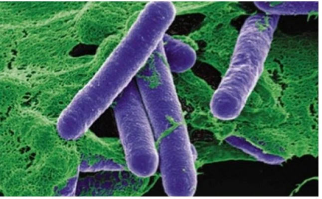 trẻ bị ngộ độc botulinum