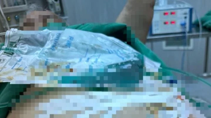 tự cắt dương vật