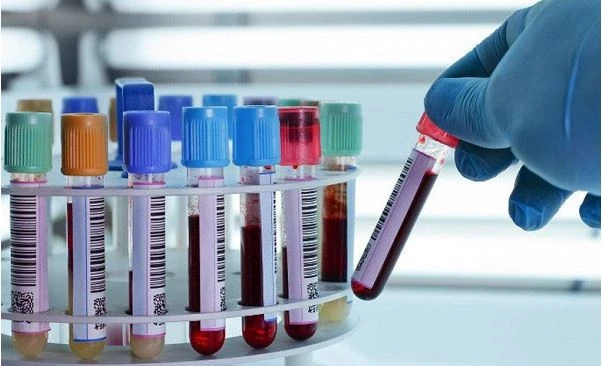 xét nghiệm máu có phải nhịn ăn