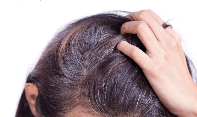 Nhuộm tóc bạc thường xuyên sẽ khiến tóc bạc nhanh và nhiều hơn