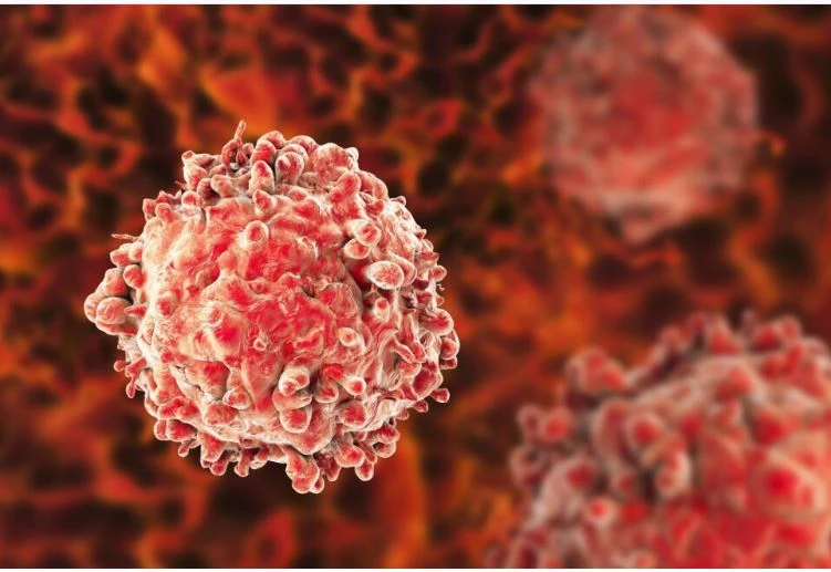 10 dấu hiệu phát hiện nguy cơ bệnh ung thư