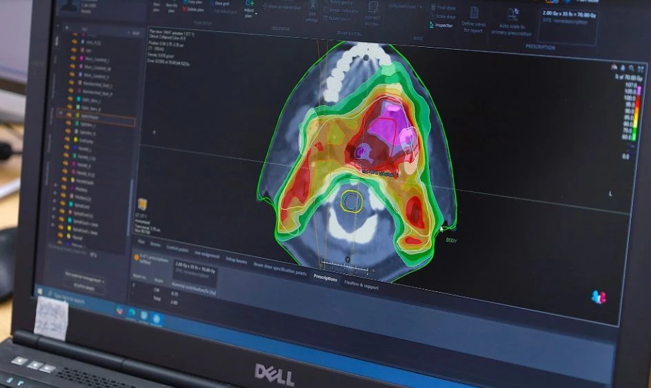 LAP KE HOACH XA TRI BANG ROBOT.JPG