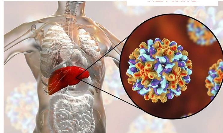 viêm gan B cấp nguy hiểm đến mức nào