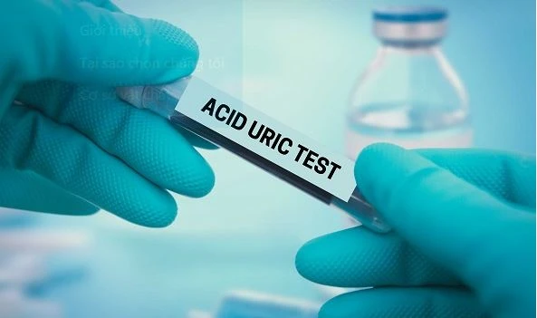Nồng độ acid uric trong máu tăng