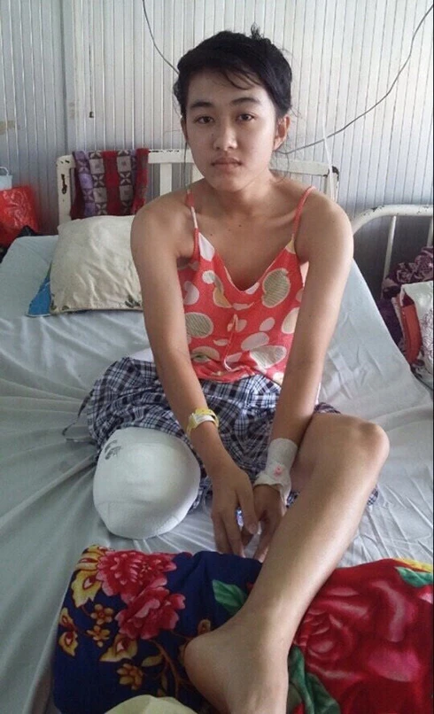 Bệnh viện nhận trách nhiệm vì nữ sinh lớp 10 bị cưa chân ảnh 1
