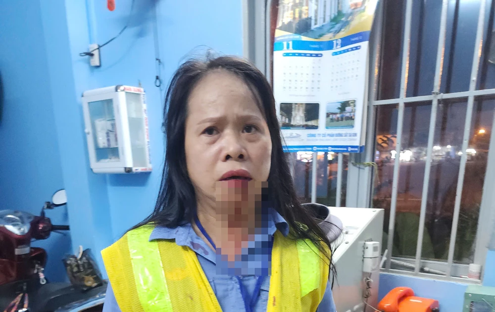 Chị Võ Thị Bình, nhân viên đường sắt bị hành hung.