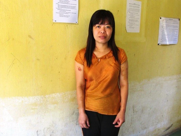 Uống 90 viên thuốc ngủ trước khi dùng búa đập vào đầu em dâu ảnh 1