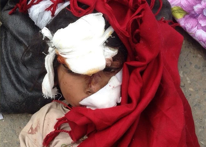 Nepal tiếp tục rung chuyển vì dư chấn động đất 6,7 độ Richter ảnh 1