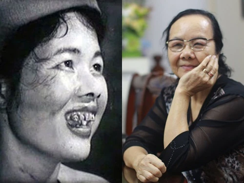 NSƯT Đức Lưu trong phim (trái) và hiện nay. DL-9660-1442995192.jpg