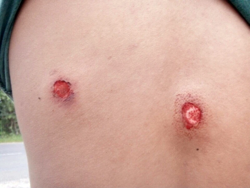 Một công dân phản ánh bị thiếu tá công an bắn vào lưng ảnh 3