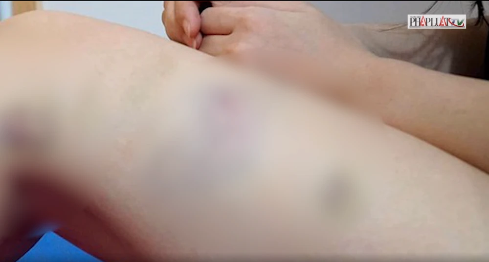 Một trường hợp người vợ tố chồng ép quan hệ tình dục từng được báo Pháp Luật TP.HCM phản ánh