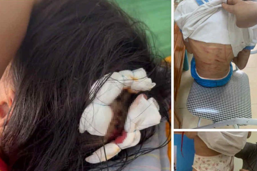 tội giết người