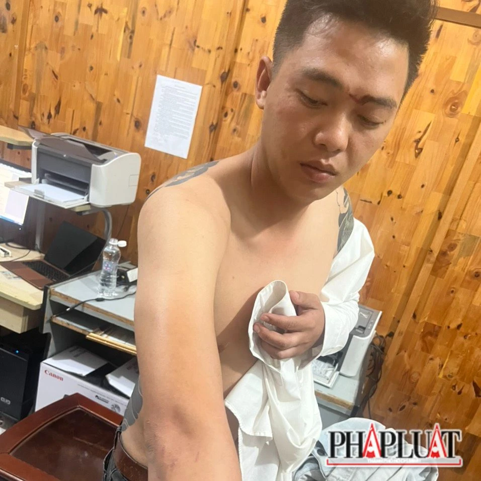 Hoàng bị bắt sau khi chém phó trưởng công an xã. Ảnh: VT Hoàng bị bắt sau khi chém phó trưởng công an xã. Ảnh: VT