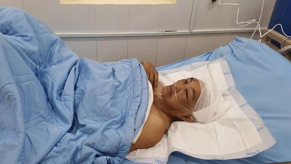 Ông Ya Tạo và vợ bị con rể đánh chấn thương sọ não. Ảnh: VÕ TÙNG