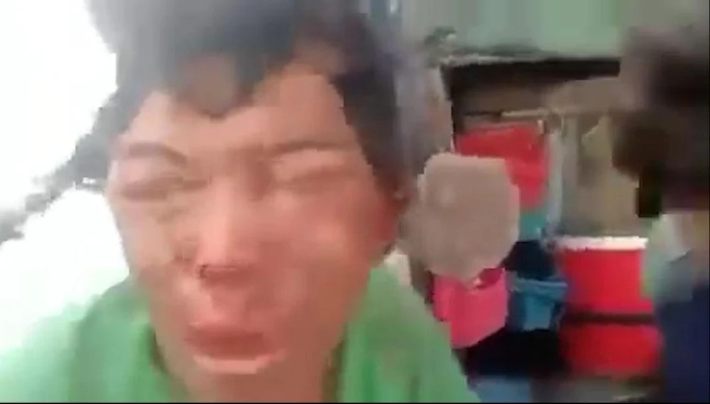 Clip thể hiện mặt ngư dân bị biến dạng. Ảnh cắt từ clip