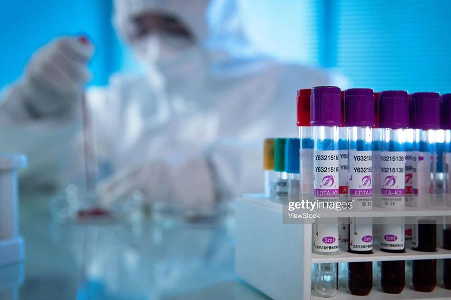 Nghiên cứu bệnh đậu mùa khỉ trên thế giới. Ảnh: GETTY IMAGES