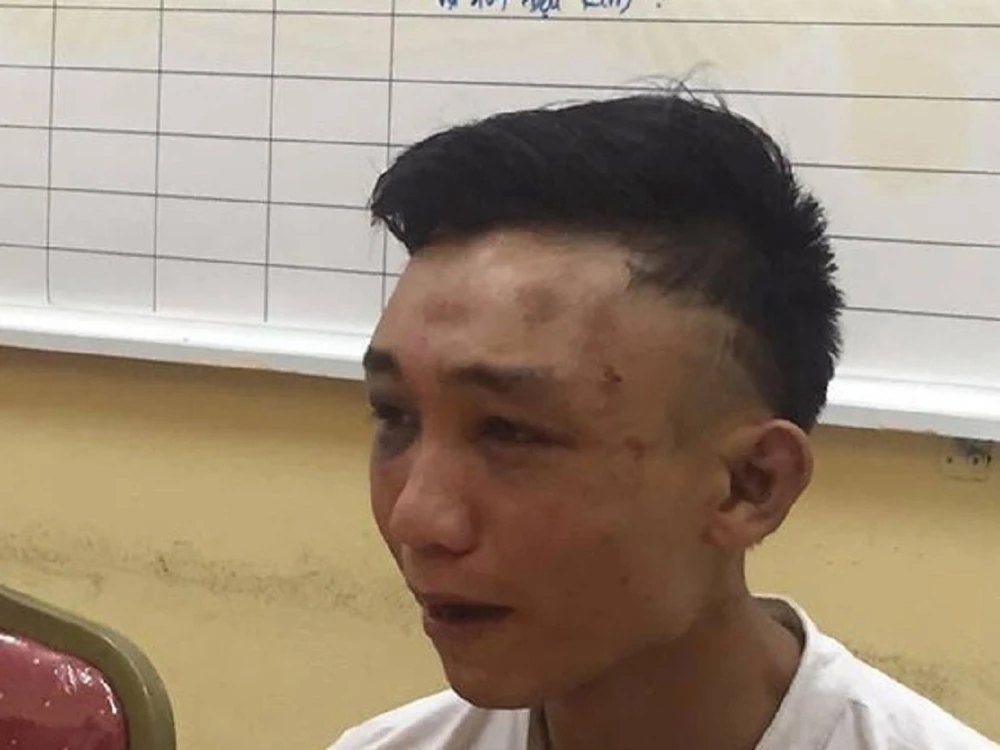 Vờ mua dầu gội, đâm gục rồi cướp túi xách của chủ quán ảnh 1