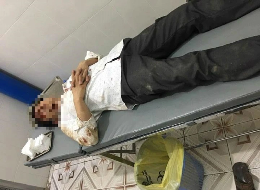 Đi đòi nợ bị đánh nhập viện ảnh 1