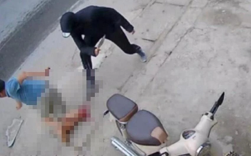 Người đàn ông bị chém lìa cẳng chân. Ảnh: T.H