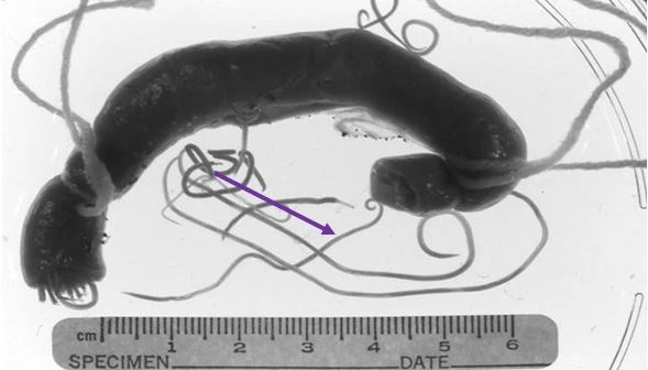 Cảnh báo viêm não do ấu trùng giun đũa chó mèo ảnh 1