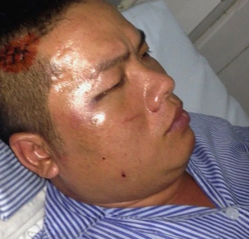 Đại ca giang hồ đất Cảng bị đàn em “xóa số“ ảnh 1