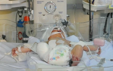 Đau đớn tháo khớp gối bé sơ sinh gặp tai nạn thảm khốc ảnh 1