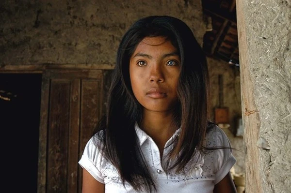 Cô gái có đôi mắt hai màu kỳ lạ ở Ninh Thuận ảnh 2