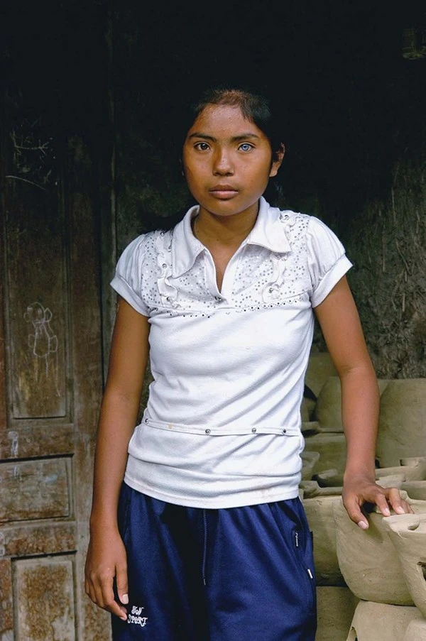 Cô gái có đôi mắt hai màu kỳ lạ ở Ninh Thuận ảnh 6