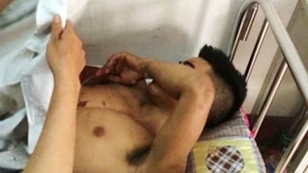 Tuấn đang được điều trị tại bệnh viện.