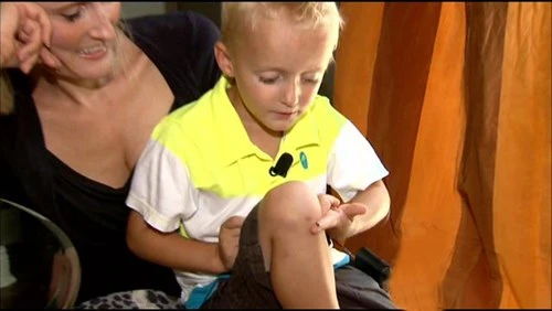 Hãi hùng ốc sên biển 'sống' trong đầu gối bé trai - ảnh 1