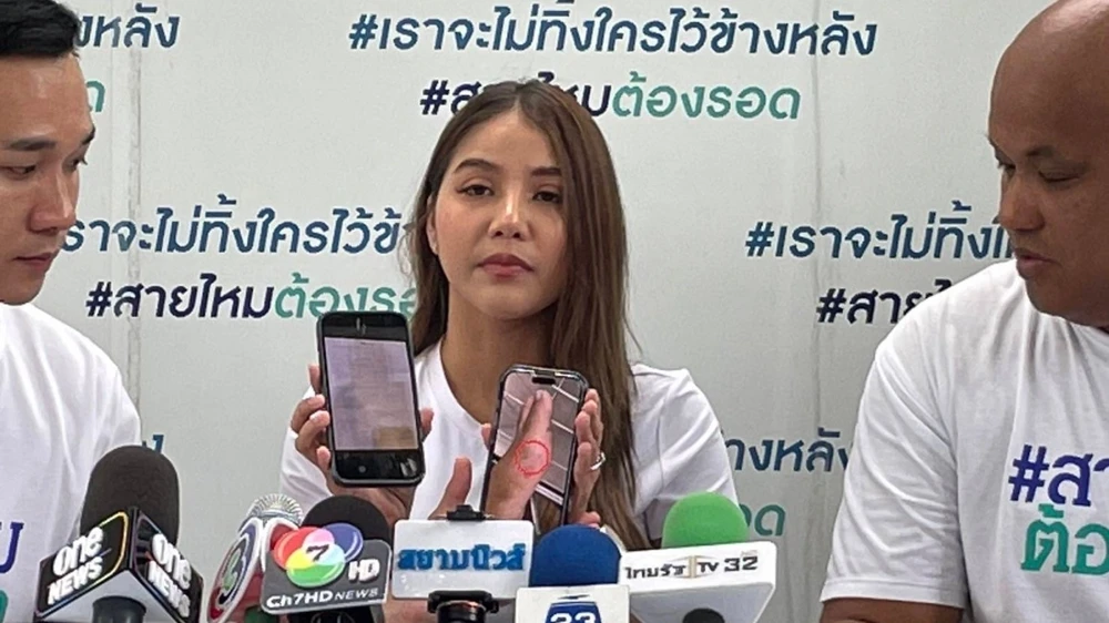 Bị rắn cắn trong rạp chiếu phim.jpg